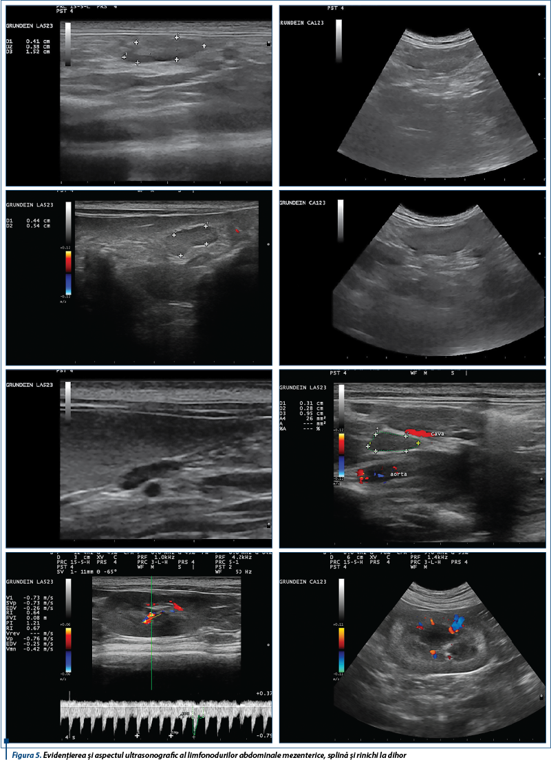 Evidențierea și aspectul ultrasonografic al limfonodurilor abdominale mezenterice, splină și rinic