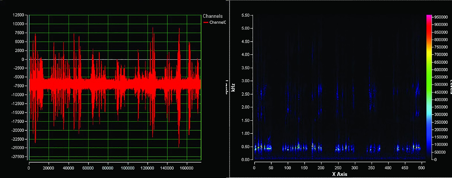 Figurile 10 și 11. Pacientul cu buton fonator are un spectru mai bogat în armonice, precum şi o intensitate sonoră superioară 