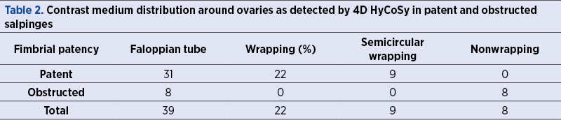 Table 2. Contrast medium distribution around ovaries as detected by 4D HyCoSy in patent and obstructed salpinges