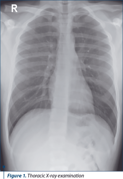 Figure 1. Thoracic X-ray examination