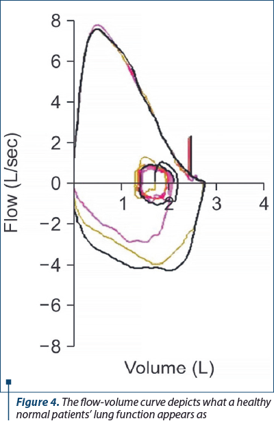 Figure 4. The flow-volume curve depicts what a healthy normal patients’ lung function appears as