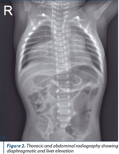 Figure 2. Thoracic and abdominal radiography showing diaphragmatic and liver elevation