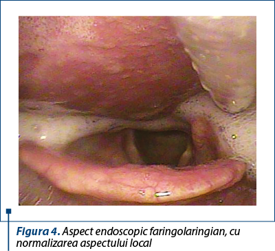 Figura 4. Aspect endoscopic faringolaringian, cu normalizarea aspectului local