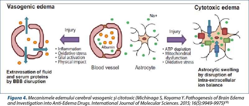 Figura 4. Mecanismele edemului cerebral vasogenic şi citotoxic (Michinaga S, Koyama Y. Pathogenesis of Brain Edema and Investigation into Anti-Edema Drugs. International Journal of Molecular Sciences. 2015; 16(5):9949-9975)(10)
