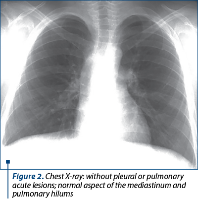 Figure 2. Chest X-ray: without pleural or pulmonary acute lesions; normal aspect of the mediastinum and pulmonary hilums