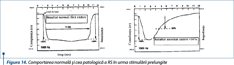 Figura 14. Comportarea normală şi cea patologică a RS în urma stimulării prelungite