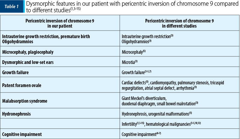 Table 1 Dysmorphic features in our patient with pericentric inversion of chromosome 9 compared to different studies(1,3-15)