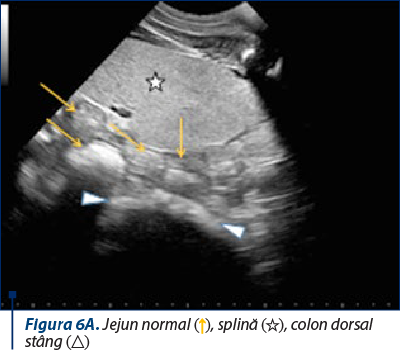 Figura 6A. Jejun normal (↑), splină (☆), colon dorsal stâng (△)