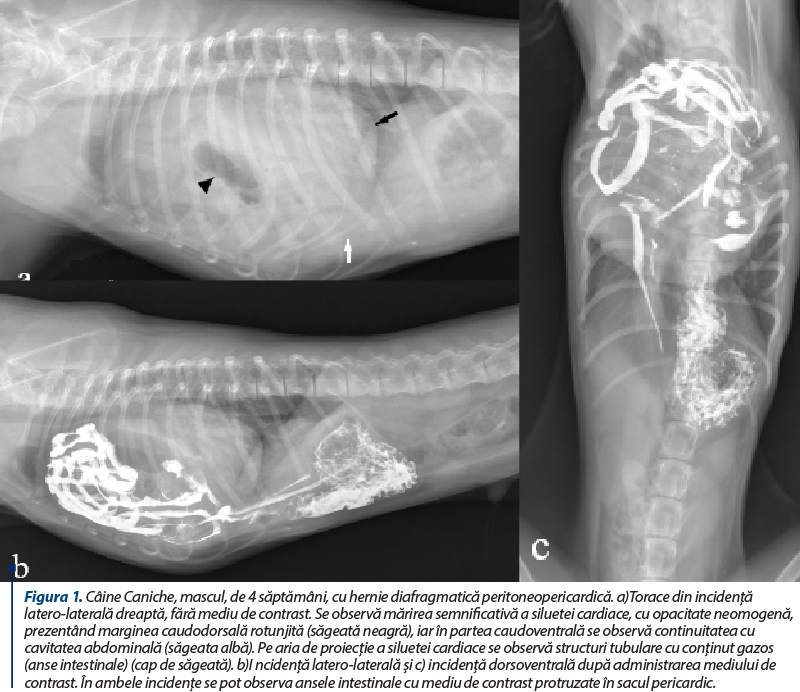 Figura 1. Câine Caniche, mascul, de 4 săptămâni, cu hernie diafragmatică peritoneopericardică. a)Torace din incidenţă latero-laterală dreaptă, fără mediu de contrast. Se observă mărirea semnificativă a siluetei cardiace, cu opacitate neomogenă, prezentând marginea caudodorsală rotunjită (săgeată neagră), iar în partea caudoventrală se observă continuitatea cu cavitatea abdominală (săgeata albă). Pe aria de proiecţie a siluetei cardiace se observă structuri tubulare cu conţinut gazos (anse intestinale) (cap de săgeată). b)I ncidenţă latero-laterală şi c) incidenţă dorsoventrală după administrarea mediului de contrast. În ambele incidenţe se pot observa ansele intestinale cu mediu de contrast protruzate în sacul pericardic.