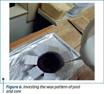 Figure 6. Investing the wax pattern of post  and core