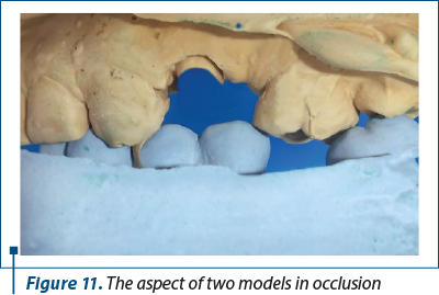 Figure 11. The aspect of two models in occlusion
