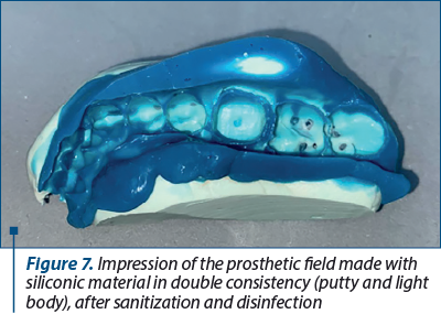 Figure 7. Impression of the prosthetic field made with siliconic material in double consistency (putty and light body), after sanitization and disinfection