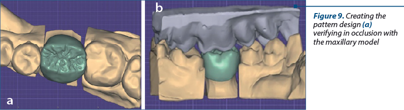 Figure 9. Creating the pattern design (a) and verifying in occlusion with the maxillary model (b) 
