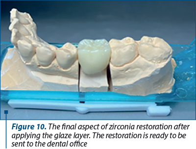 Figure 10. The final aspect of zirconia restoration after applying the glaze layer. The restoration is ready to be sent to the dental office 