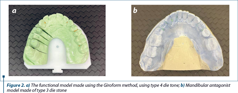 Figure 2. a) The functional model made using the Giroform method, using type 4 die tone; b) Mandibular antagonist model made of type 3 die stone