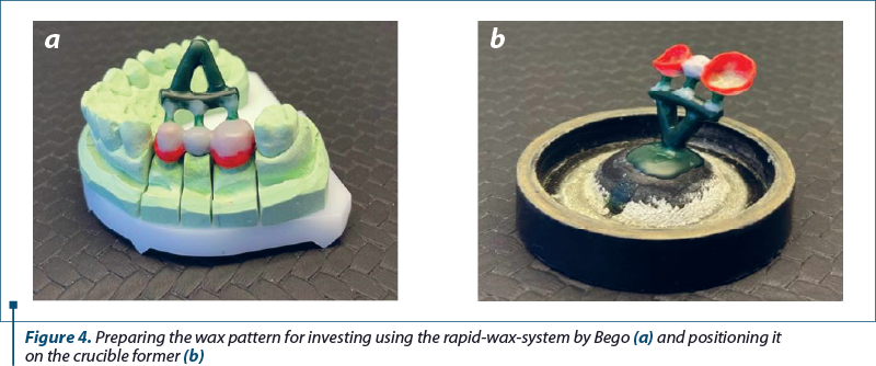 Figure 4. Preparing the wax pattern for investing using the rapid-wax-system by Bego (a) and positioning it  on the crucible former (b)