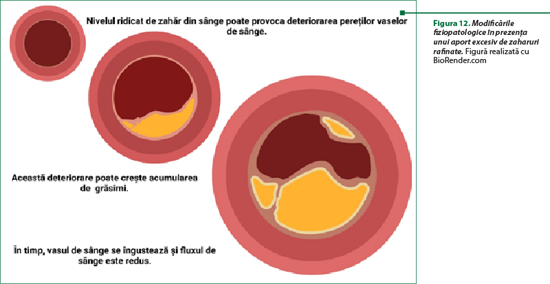 Figura 12. Modificările fiziopatologice în prezenţa unui aport excesiv de zaharuri rafinate. Figură realizată cu BioRender.com