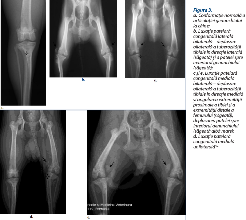 Figura 3. a. Conformaţie normală a articulaţiei genunchiului la câine; b. Luxaţie patelară congenitală laterală bilaterală – deplasare bilaterală a tuberozităţii tibiale în direcţie laterală (săgeată) şi a patelei spre exteriorul genunchiului (săgeată); c şi e. Luxaţie patelară congenitală medială bilaterală – deplasare bilaterală a tuberozităţii tibiale în direcţie medială şi angularea extremităţii proximale a tibiei şi a extremităţii distale a femurului (săgeată), deplasarea patelei spre interiorul genunchiului (săgeată albă mare); d. Luxaţie patelară congenitală medială unilaterală(37)