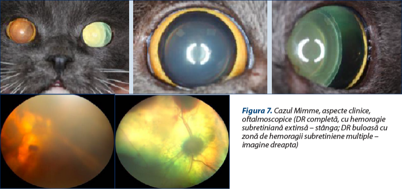 Figura 7. Cazul Mimme, aspecte clinice, oftalmoscopice (DR completă, cu hemoragie subretiniană extinsă – stânga; DR buloasă cu zonă de hemoragii subretiniene multiple – imagine dreapta)