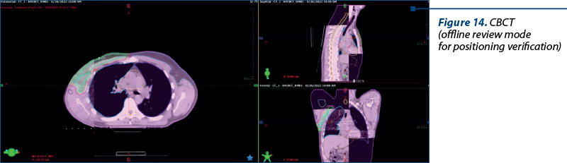 Figure 14. CBCT  (offline review mode  for positioning verification)