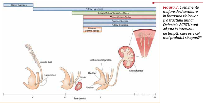 Figura 3. Evenimente majore de dezvoltare în formarea rinichilor şi a tractului urinar. Defectele ACRTU sunt afişate în intervalul  de timp în care este cel mai probabil să apară(1)