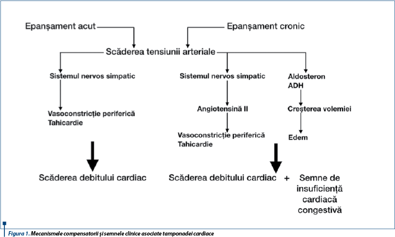 Figura 1. Mecanismele compensatorii și semnele clinice asociate tamponadei cardiace