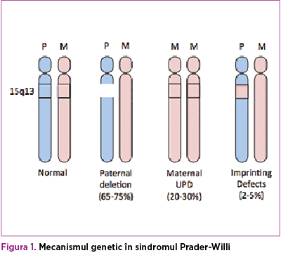 Figura 1. Mecanismul genetic în sindromul Prader-Willi