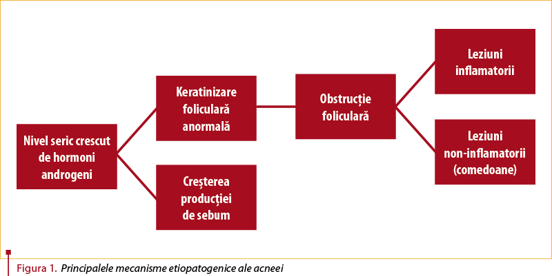 Figura 1. Principalele mecanisme etiopatogenice ale acneei