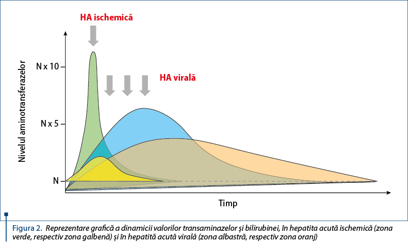 Figura 2. Reprezentare grafică a dinamicii valorilor transaminazelor şi bilirubinei, în hepatita acută ischemică (zona verde, respectiv zona galbenă) şi în hepatită acută virală (zona albastră, respectiv zona oranj)
