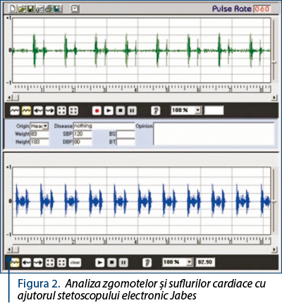 Figura 2. Analiza zgomotelor şi suflurilor cardiace cu ajutorul stetoscopului electronic Jabes