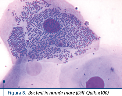 Figura 8. Bacterii în număr mare (Diff-Quik, x100) 