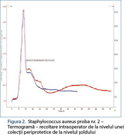Figura 2. Staphylococcus aureus proba nr. 2 – Termogramă – recoltare intraoperator de la nivelul unei colecţii periprotetice de la nivelul şoldului