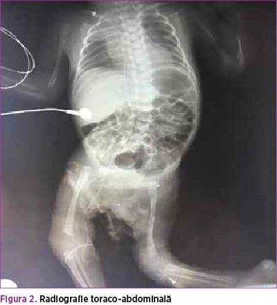 Figura 2. Radiografie toraco-abdominală