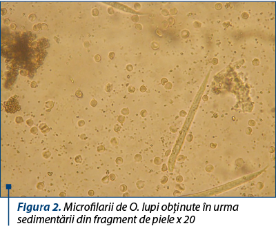Figura 2. Microfilarii de O. lupi obţinute în urma sedimentării din fragment de piele x 20