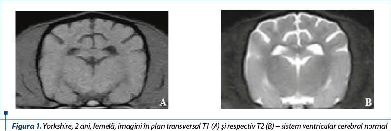 Figura 1. Yorkshire, 2 ani, femelă, imagini în plan transversal T1 (A) şi respectiv T2 (B) − sistem ventricular cerebral normal