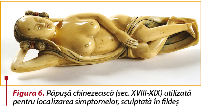 Figura 6. Păpuşă chinezească (sec. XVIII-XIX) utilizată pentru localizarea simptomelor, sculptată în fildeş
