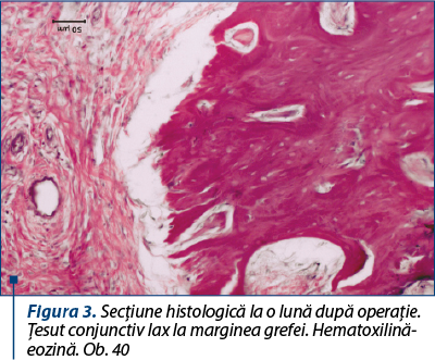Figura 3. Secţiune histologică la o lună după operaţie. Ţe­sut conjunctiv lax la marginea grefei. He