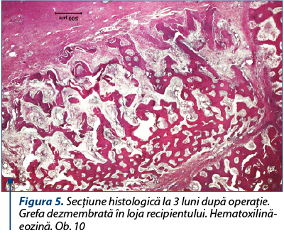 Figura 5. Secţiune histologică la 3 luni după operaţie. Grefa dezmembrată în loja recipientului. Hematoxilină-eozină. Ob. 10