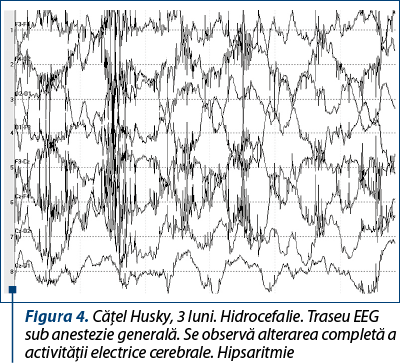 Figura 4. Căţel Husky, 3 luni. Hidrocefalie. Traseu EEG sub anestezie generală. Se observă alterarea completă a activităţii electrice cerebrale. Hipsaritmie