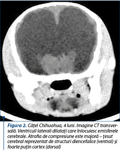 Figura 2. Căţel Chihuahua, 4 luni. Imagine CT trans­ver­sală. Ventriculi laterali dilataţi care înlocuiesc emisferele cerebrale. Atrofia de compresiune este majoră – ţesut cerebral reprezentat de structuri diencefalice (ventral) şi foarte puţin cortex (dorsal)