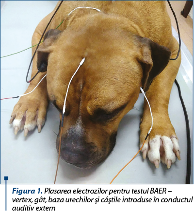 Figura 1. Plasarea electrozilor pentru testul BAER – vertex, gât, baza urechilor şi căştile introduse în conductul auditiv extern