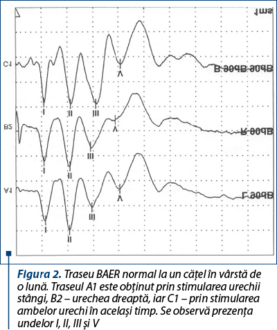 Figura 2. Traseu BAER normal la un căţel în vârstă de o lună. Traseul A1 este obţinut prin stimularea urechii stângi, B2 – urechea dreaptă, iar C1 – prin stimularea ambelor urechi în acelaşi timp. Se observă prezenţa undelor I, II, III şi V