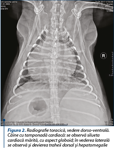 Figura 2. Radiografie toracică, vedere dorso-ventrală. Câine cu tamponadă cardiacă: se observă silueta cardiacă mărită, cu aspect globoid; în vederea laterală se observă şi devierea traheii dorsal şi hepatomegalie