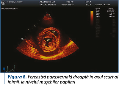 Figura 8. Fereastră parasternală dreaptă în axul scurt al inimii, la nivelul muşchilor papilari