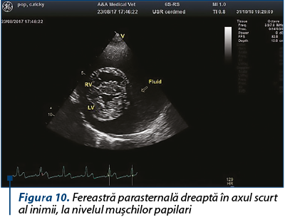 Figura 10. Fereastră parasternală dreaptă în axul scurt al inimii, la nivelul muşchilor papilari 