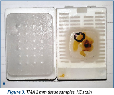 Figure 3. TMA 2 mm tissue samples, HE stain