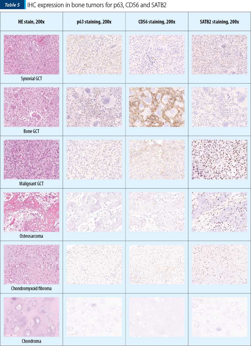 Table 5. IHC expression in bone tumors for p63, CD56 and SATB2