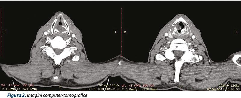 Figura 2. Imagini computer-tomografice