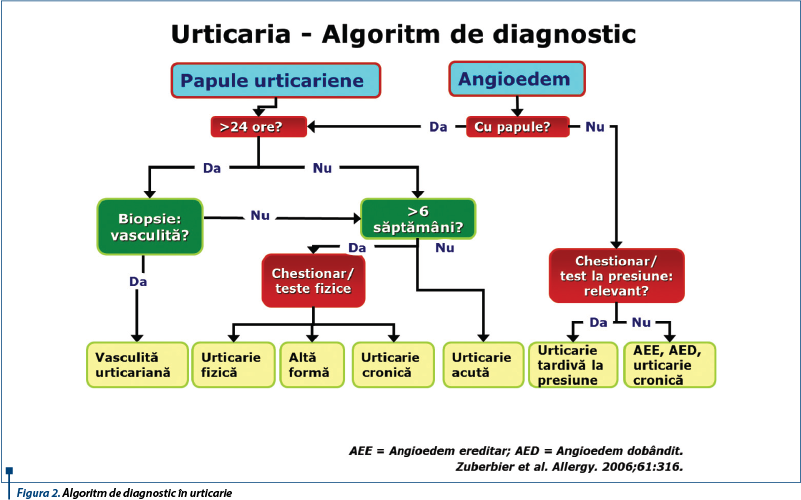 Algoritm de diagnostic în urticarie