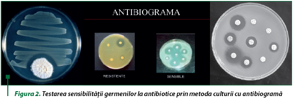 Figura 2. Testarea sensibilităţii germenilor la antibiotice prin metoda culturii cu antibiogramă